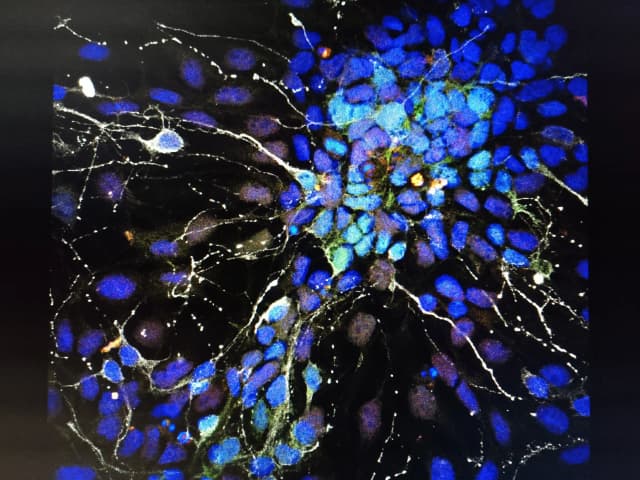 Microscopy picture of Differentiated stem cells into Dopaminergic cells with bluish colors taken by Sandrina Maçãs