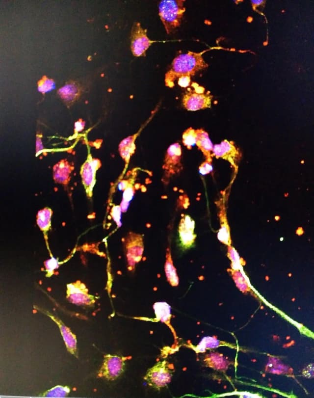 Microscopy picture of Differentiated stem cells into Dopaminergic cells with purplish colors taken by Sandrina Maçãs